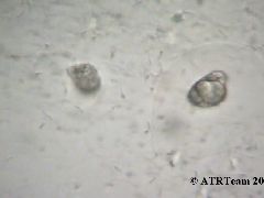 clam-sperm1b